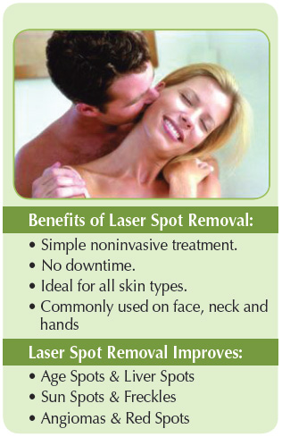 Benefits of Laser Spot Removal