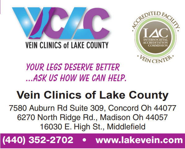 IF YOU HAVE VARICOSE VEINS, DON’T IGNORE THEM  -  Dr. Razieh Mohseni, Vein Clinics of Lake County